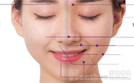 假体隆鼻后注意事项有哪些?假体隆鼻后遗症有哪些?