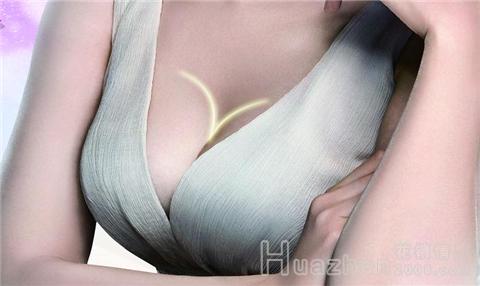 整形隆胸方法有哪些？