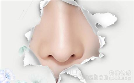 鼻部综合整形优点和副作用是什么？